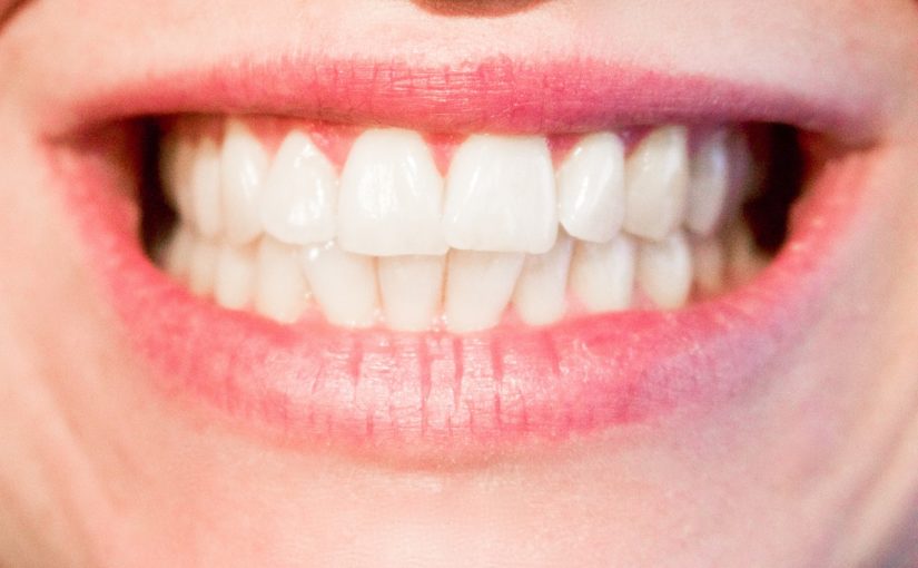 Obecna technika stosowana w salonach stomatologii estetycznej zdoła spowodować, że odzyskamy prześliczny uśmiech.